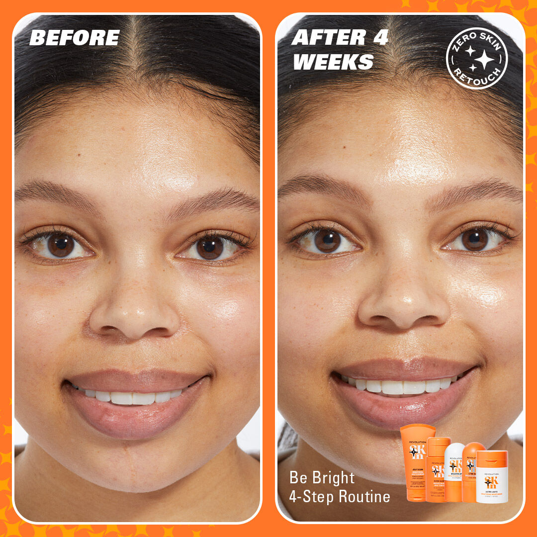 2.Lois-BB-4weeks_beforeandafter-1×1